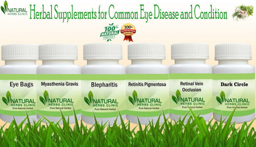 The characteristics of Herbal Supplements for Sexual Disease effectively diminish the disease’s symptoms and underlying causes. https://www.naturalherbsclinic.com/blog/utilize-herbal-supplements-to-maintain-man-health/