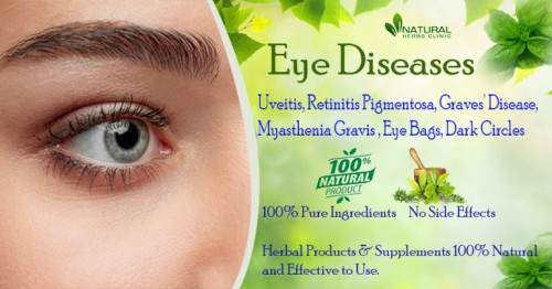 Home remedies and Herbal Supplements for Eye Disease are excellent ways to treat a variety of eye problems and disorders. https://www.naturalherbsclinic.com/blog/eye-disease-suitable-option-to-treat-with-herbal-supplements/