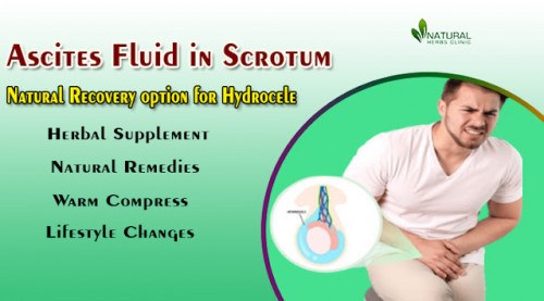Welcome to our informative guide on Ascites Fluid in Scrotum. This condition, also known as Hydrocele, is a common medical condition that affects many men. https://natural-herbsclinic.blogspot.com/2024/01/ascites-fluid-in-scrotum-information.html