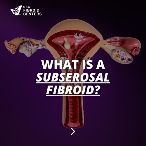 What Is Intramural Fibroid? Learn about this common type of uterine fibroid, its symptoms, causes, and treatment options. Discover how to manage intramural fibroids and improve your quality of life. Visit USA Fibroid Centers for expert guidance. Please visit :https://www.usafibroidcenters.com/blog/what-are-intramural-fibroids-and-how-do-you-treat-them/