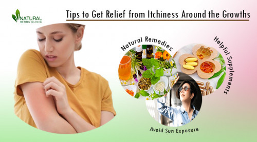 Are you feeling Itchiness Around the Growths on your body? Learn how you can best manage this uncomfortable symptom. https://www.naturalherbsclinic.com/blog/itchiness-around-the-growths-policy-to-get-relief-from-itchiness/
