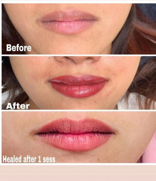 Achieve the perfect pout with Lip Tattooing Services by Cosmetic Tattooing Melbourne. Our skilled professionals specialize in enhancing lip contours and adding a touch of color for a natural and beautiful result. Explore the world of semi-permanent makeup and wake up to beautifully defined lips every day. Read more: https://cosmetictattooingmelbourne.com.au/lip-tattooing/


#CosmeticTattooingMelbourne #cosmetictattooing #liptattooing #liptattoos